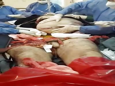 Shock still with half-party life being operated 