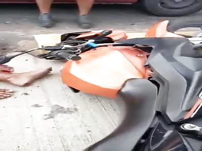 Woman with shattered leg in agony