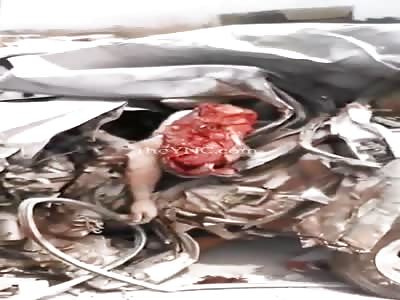  Shocking accident man is faceless