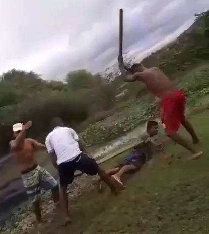 Pain in Brazilian Woods