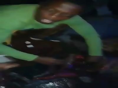 Man in agony after being shot in the legs 