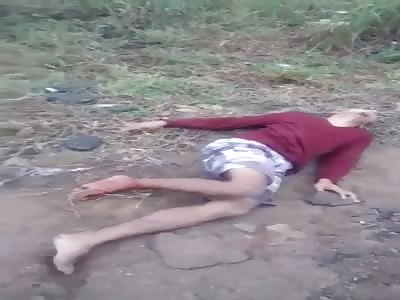 The fucking bike... Motorcycle accident waiting for help 