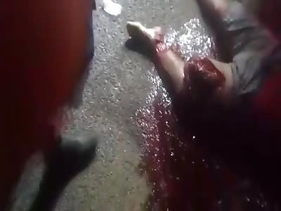 Man in agony with shattered leg after accident 