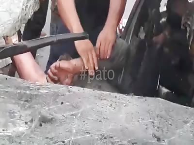 At Least He`s Not Burned to Crisp (Another Version)