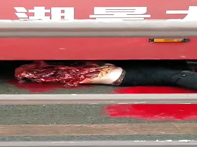 You Can See Through His Torso