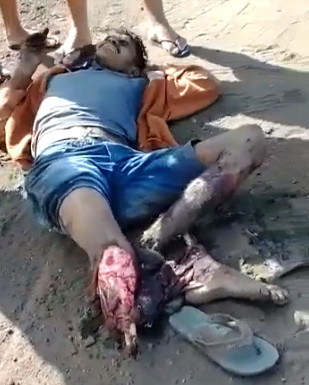 Buddy Shows Us His Brutal Trauma