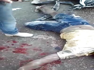 The fucking bike. Man in agony after motorcycle accident 