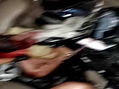  Shocking accident driver and passenger in agony 