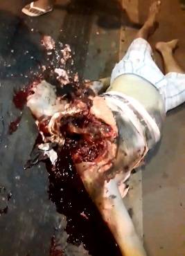 Head Exploded Open Like a Cantaloupe