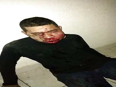 Wtf. Man's plea helps after beating 