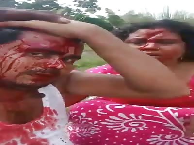 Couple punished. (woman with big cut on face) 