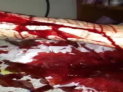 Shocking likes pain cutting his arms