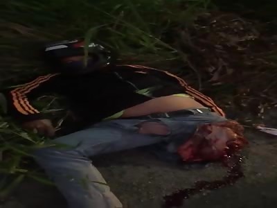 Shocking man loses leg in motorcycle accident  