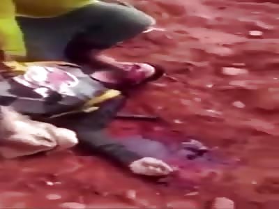 Accident Of Work With Several Wounded