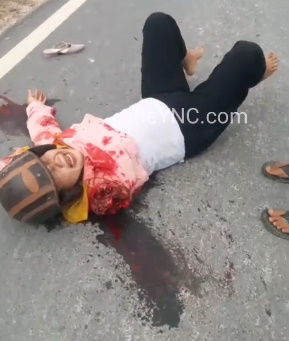 Girl with Arm Ripped Clean off is in a Complete State of Shock