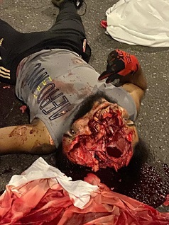 Literally Cracked His Skull