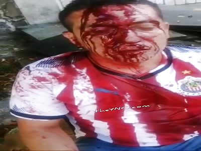 Thief  Brutally Punished 