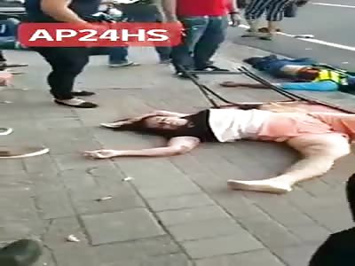 SHOCKING ACCIDENT Woman with shattered leg 