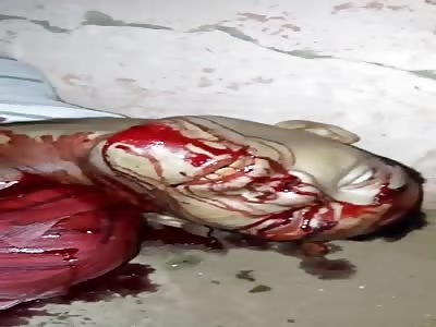 Disturbing Face of Homicide in Brazil