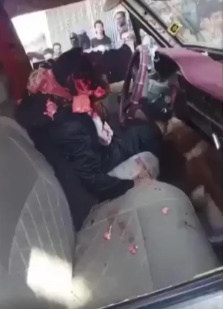 Yemeni Man with Head Split Wide Open