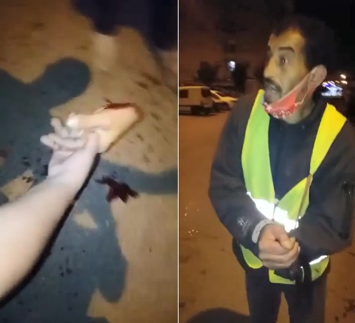 Sudden Attack Costs Elderly His HAND