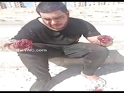 Kidnapped and mutilated with machete.