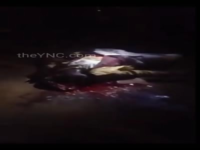 Man with shattered head after accident.