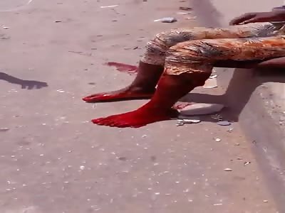 Man in agony with his leg pierced by a gunshot