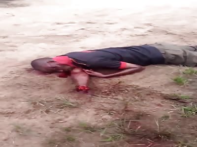 SHOCKING they amputate his hands to ask for ransom 