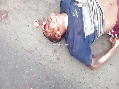 DAMN. man with shattered head.