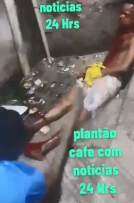 Rival Gets Knee Broken By Gang