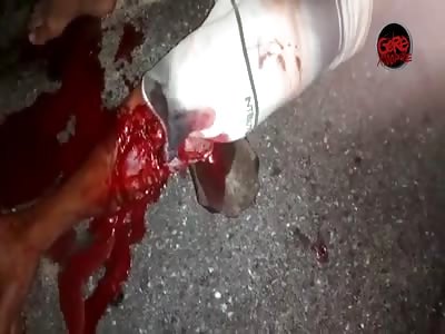 accident. motorcycle in agony with shattered leg