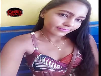 ACCIDENT .. Beautiful Chick Shattered After Being Runover.