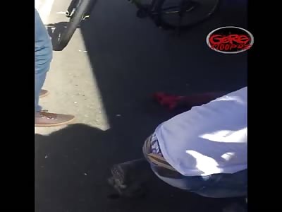 Woman in agony after accident