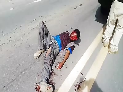 man in agony with shattered leg after accident