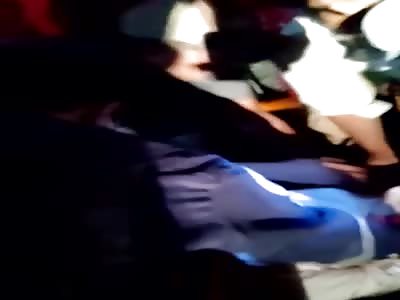 brutal accident leaves man with a shattered face