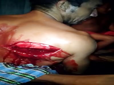 Machetes Don't Leave You Looking Pretty