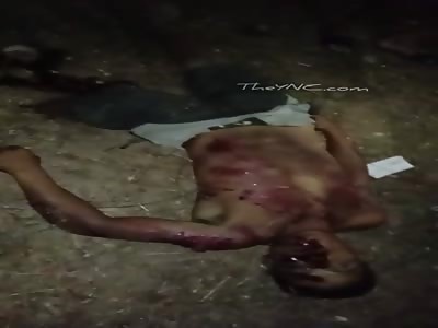 body destroyed after accident