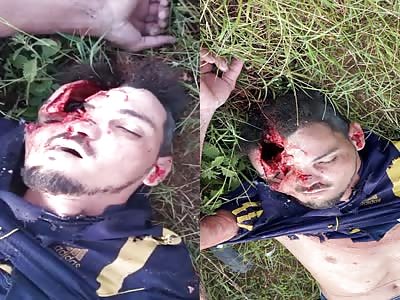 Literally Cracked His Skull in Brazil