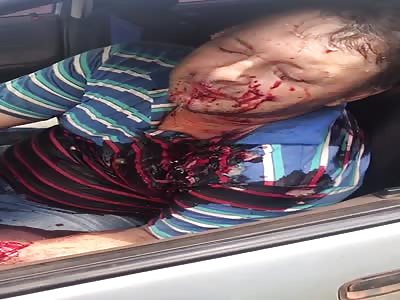 Man in agony after accident