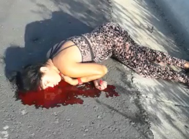 Looks Like Bullet Wounds