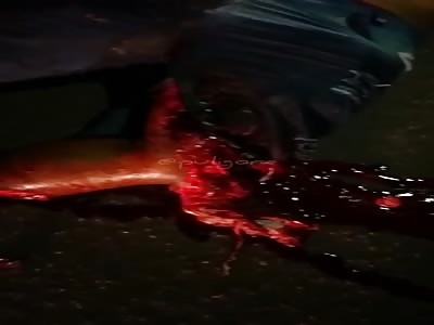 misfortune, man with shattered leg in accident