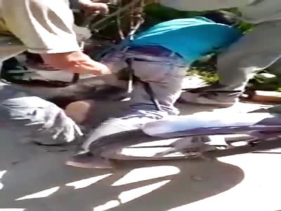 Dam.  accident at work stabs iron in the back and comes out of the ass