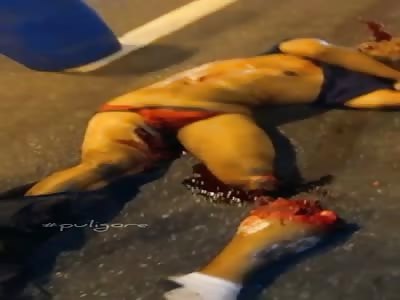 brutal accident   leaves man with shattered leg