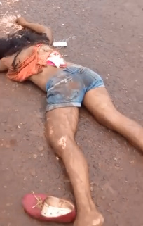 Girl Literally Cracked Her Skull 