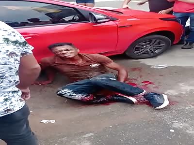 man in agony with shattered leg 