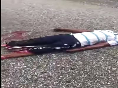 shit man Lose both feet in action