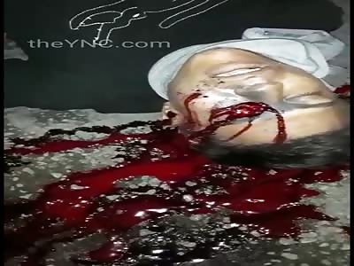 Murdered man with head shot Brazil