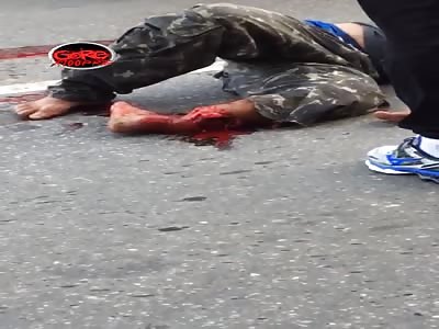 shattered leg after accident