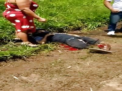 danm  Motorcyclist with shattered legs after accident